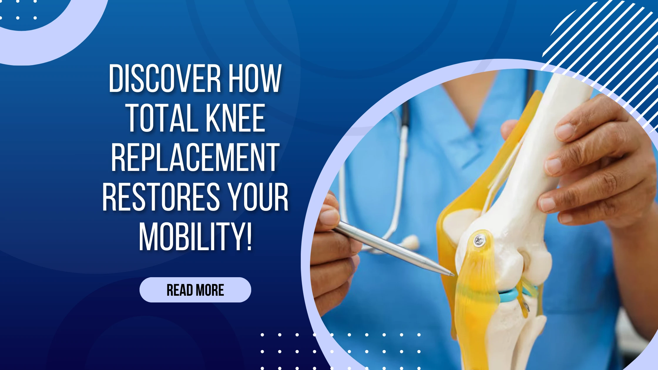 Total Knee Replacement (TKR): The Key to Restoring Mobility and Pain Relief