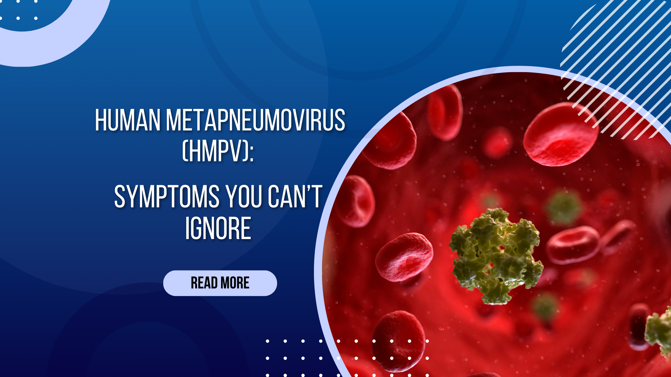 Human metapneumovirus (Hmpv): Symptoms You Shouldn’t Ignore and How to Protect Yourself!