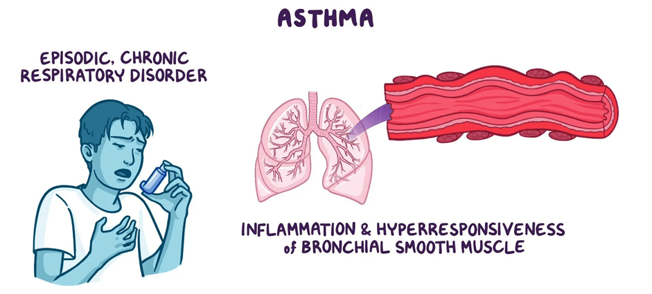 Homeopathic remedies for bronchial asthma, including Arsenicum Album, Natrum Sulphuricum, and Ipecac, displayed on a wooden table